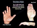 Nerve Injury Position of the Hand & Fingers - Everything You Need To Know - Dr. Nabil Ebraheim