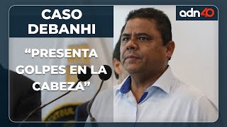 Presenta golpes en la cabeza: se filtran los resultados de la segunda autopsia de Debanhi Escobar