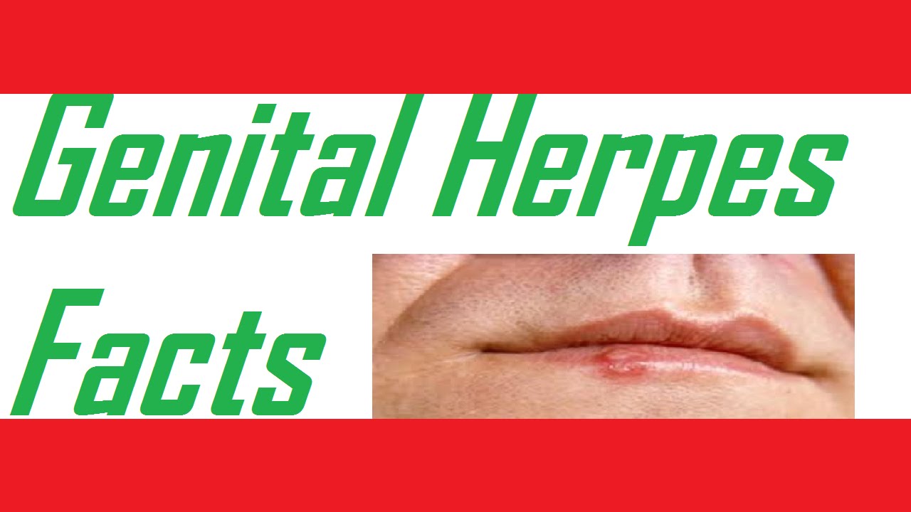 How Can you Get Genital Herpes ? Genital Herpes Facts