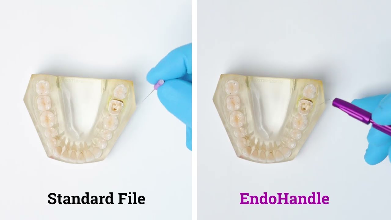 Endo Handle Initial Endo Canal Management File Holder