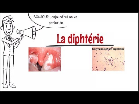 Vidéo: Diphtérie - Qui Est L'agent Causal? Quels Sont Les Symptômes? Traitement