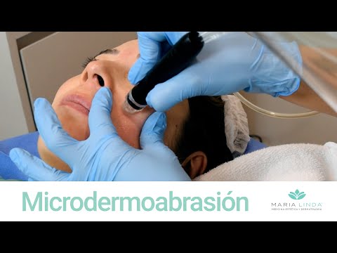 TRATAMIENTO FACIAL - Microdermoabrasión | María Linda