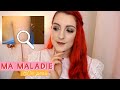 Ma maladie de peau : je vous dis tout 😫  Kératose Pilaire.. & mes conseils ! | LOdoesmakeup