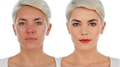 Makeup Tips for Redness and Rosacea - Simple Statement Look
