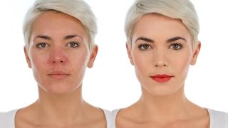 Makeup Tips for Redness and Rosacea - Simple Statement Look