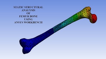 Femur Bone | Static Structural Analysis I Deformation | Stress | Strain | ANSYS Workbench