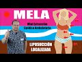 MELA (Mini Extracción Lipídica Ambulatoria) 🔥 Lipo LOCALIZADA 👙 Liposicción ZONAL 🔥 Dr ALBERTO CALVO