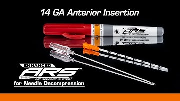 Enhanced ARS - 14 GA Anterior Decompression