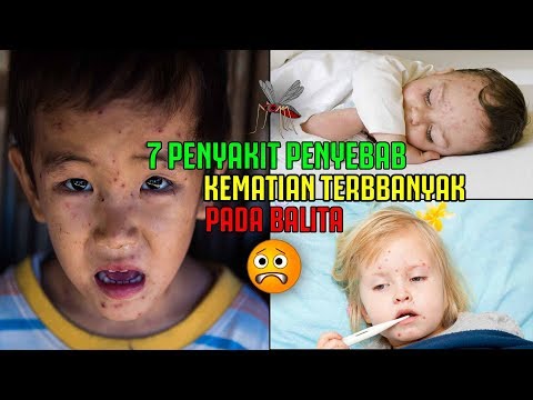 Video: Hipertrofi Tonsil Dan Prolaps Pada Anak - Apakah Epiglottitis Merupakan Faktor Predisposisi Untuk Kematian Mendadak Yang Tidak Terduga?