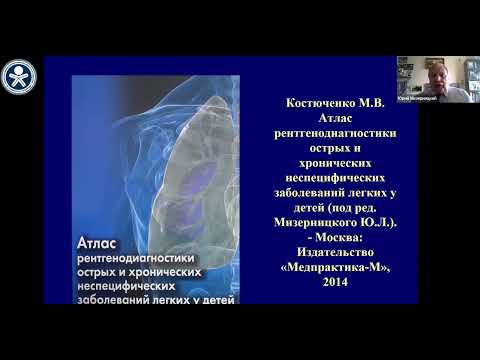 "Вельтищевские пятницы" Внебольничные пневмонии у детей