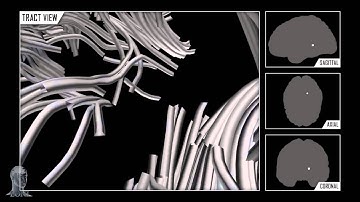 Navigating The Connectome