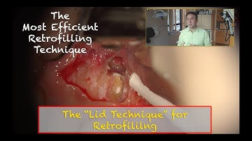Lid Technique for Retrofiling