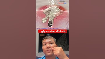 Đinh râu nhọt do cạo râu quá nhẵn 🥲 #animation #3danimation #skincare #drninh