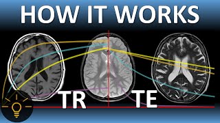 TR, TE & MRI Image Weighting (T1, T2, PD) EXPLAINED | MRI Physics Course Lecture 7 screenshot 4