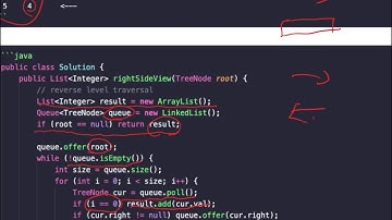 贾考博 LeetCode 199. Binary Tree Right Side View - 上看下看左看右看，每一棵树都不简单～