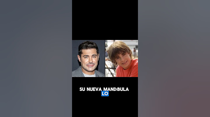Zac Efron del 2000 al 2025: ¿Qué le pasó en la cara? 🧑‍🎤 #ZacEfron #Transformación #Hollywood