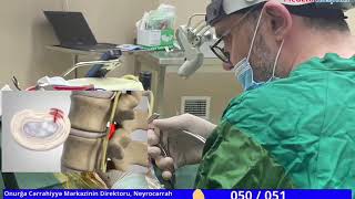 Neyrocərrah Əliosman Qədimbəyli 0552966668