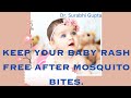 Say bye bye to marks of mosquito bites  easy home remedy is here 