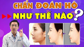 Chẩn Đoán Răng Hô | Những Dấu Hiệu Mô Mềm Đánh Giá Hô!