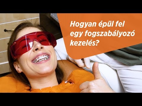 Videó: 3 módja a fogszabályozó kezelésének