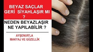 Neden Saclarin Beyazlanmis Arkadas Beyaz Saclara Ne Yapilabilir Tekrar Siyahlasir Mi Youtube