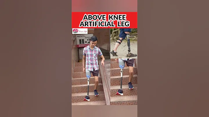 Prosthetic Above Knee Leg #ossur #shortvideo #shorts #fypp #foryou #motivation #proflex #prosthetics