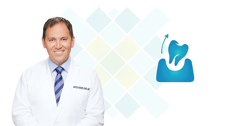 Tooth Extraction in Las Cruces NM: Dr. Heiner | Or...