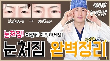 [ENG/눈성형] 눈 처짐 ❗방치❗하지말고, 이렇게 예방하세요?