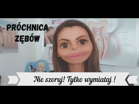 Wideo: Zapobieganie Próchnicy We Wczesnym Dzieciństwie Za Pomocą Fluorku Srebra Diaminy: Protokół Badania Dla Randomizowanego Badania Klinicznego