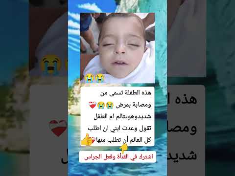 هذه الطفل يبلغ من ومصابة بمرض شديد وهويتالم ام الطفل تقول وعدت ابني ان اجعل العالم