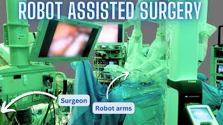 How robot assisted surgery works (as explained by a surgeon) by Max Feinstein 21,253 views 7 months ago 8 minutes, 30 seconds