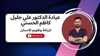 ابتسامة كاملة للأسنان مع زراعة الاسنان الفورية