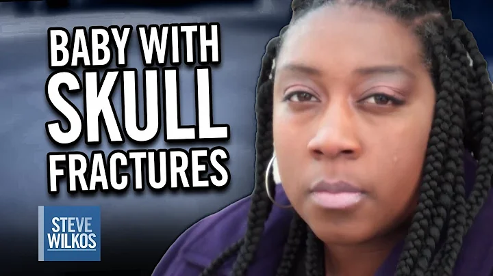 UPDATE: Child Abuse, Baby With Skull Fractures! | ...
