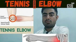 Tennis Elbow Elbow Pain Koni Me Dard Hona