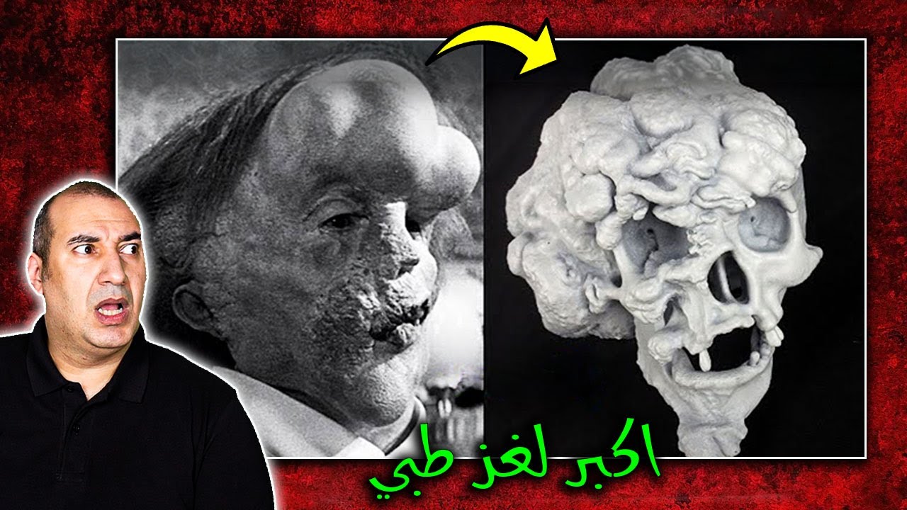 القصة المأساوية لـ 