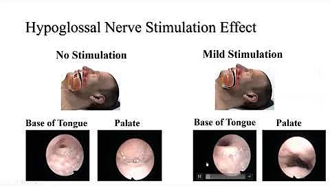 Inspire Community Health Talk - The Insomnia and Sleep Institute of Arizona