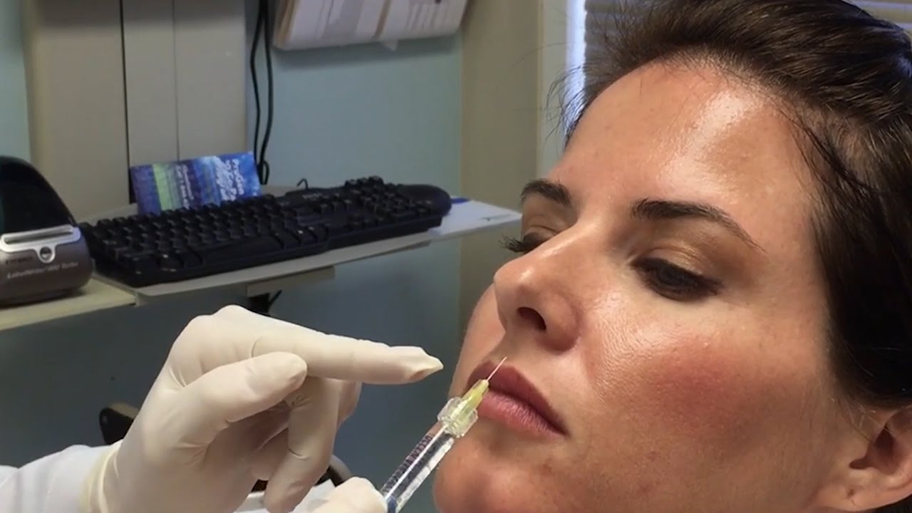 Live Demo Instantly Fuller Lips with Restylane Silk Dr. Lenore