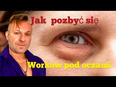 Jak pozbyć się