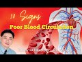 10 Signs of Poor Blood Circulation - Dr. Gary Sy