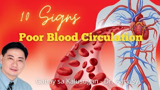 10 Signs of Poor Blood Circulation - Dr. Gary Sy