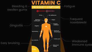 Signs of vitamin c deficiency shorts careify