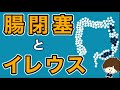 イレウスと腸閉塞の違い 治療や看護について　イレウス管って何ですか？