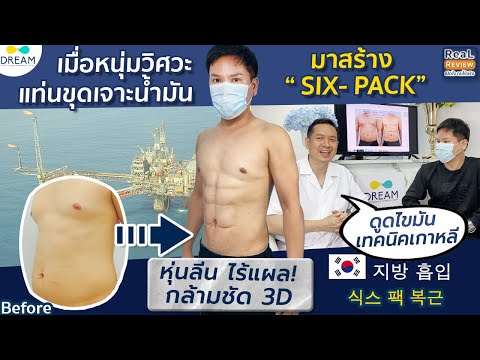 วิธีสร้างsix pack ในวัย50! หนุ่มวิศวะเลือก"ดูดไขมันเทคนิคเกาหลี"เพราะคุ้มที่สุด