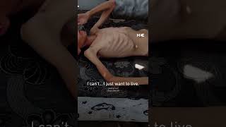 Gaza Child Pleads For Life As Israels Blockade Fuels Starvation