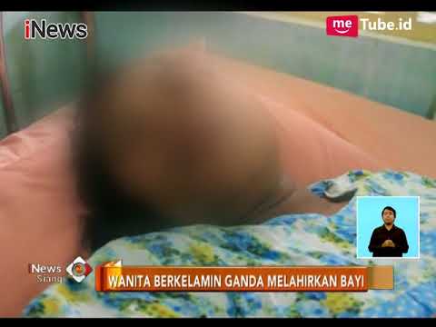 Wanita Berkelamin Ganda Melahirkan Bayi Laki-laki - iNews Siang 03/11