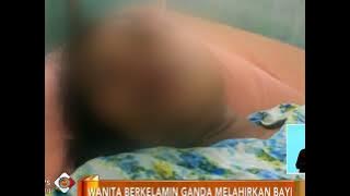 Wanita Berkelamin Ganda Melahirkan Bayi Laki-laki - iNews Siang 03/11