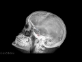 Introducción a la radiología-Cráneo y cara