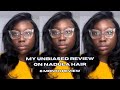 *unbiased* nadula hair review | initial thoughts + 6 mo update #nadulahair #hairreviews