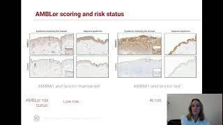 Monitoring anti-TNFα treatment, A. Abhishek et al.