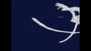 Baywatch S04E13 Credits Non-Remastered Version